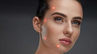 Co je frakční omlazení pleti