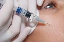Postup biorevitalizace