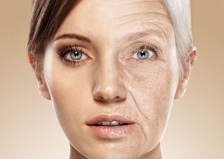 před a po laserové omlazení pokožky obličeje
