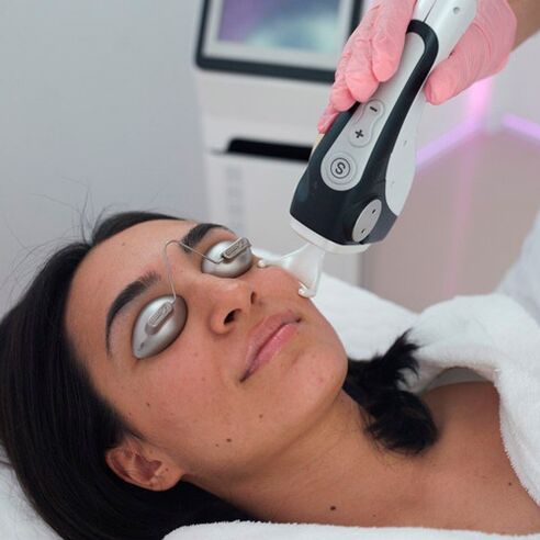 Ošetření pokožky obličeje frakčním laserem